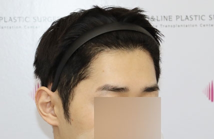 치료후기 이미지