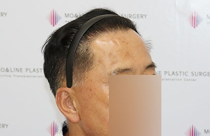 치료후기 이미지