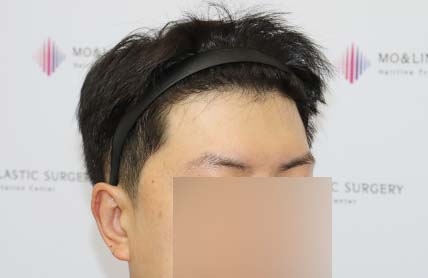 치료후기 이미지