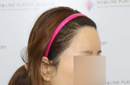 치료후기 이미지