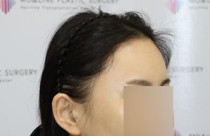 치료후기 이미지