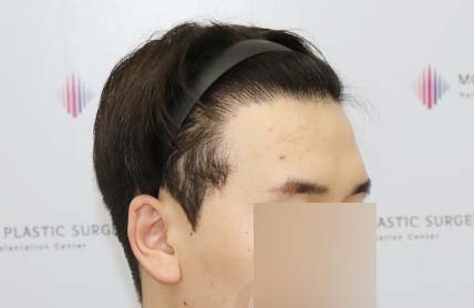 치료후기 이미지