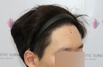 치료후기 이미지
