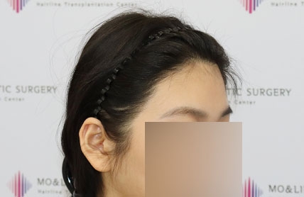 치료후기 이미지