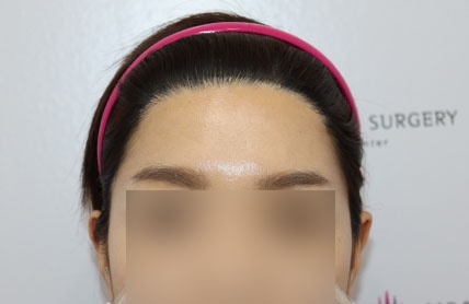 치료후기 이미지