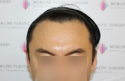 치료후기 이미지