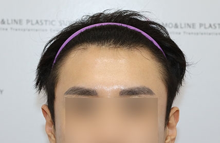 치료후기 이미지