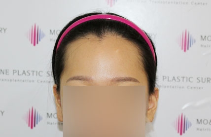 치료후기 이미지