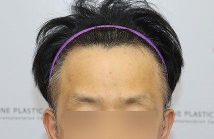 치료후기 이미지