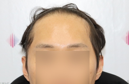 치료후기 이미지