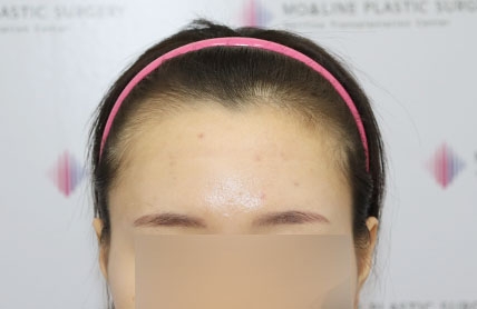 치료후기 이미지