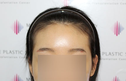 치료후기 이미지