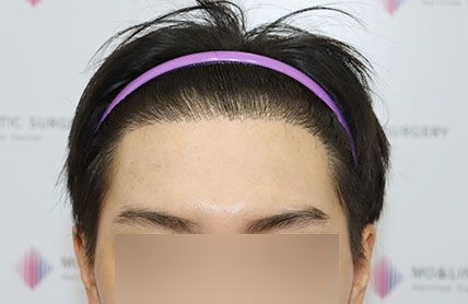 치료후기 이미지