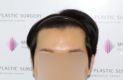 치료후기 이미지