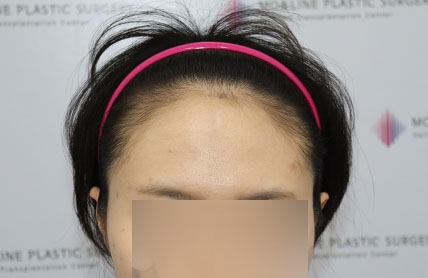 치료후기 이미지
