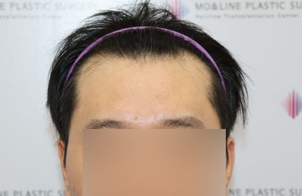 치료후기 이미지