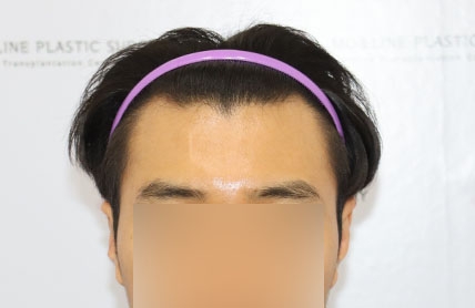 치료후기 이미지