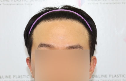 치료후기 이미지