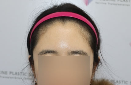 치료후기 이미지