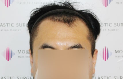 치료후기 이미지