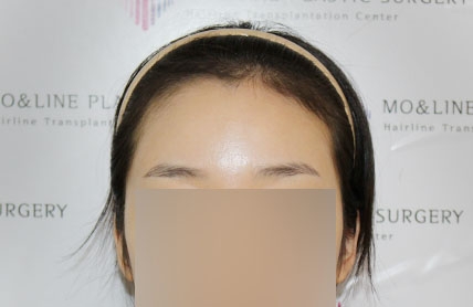치료후기 이미지