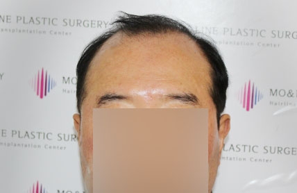 치료후기 이미지