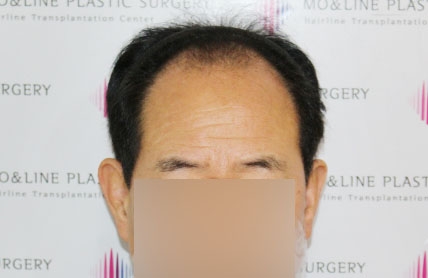 치료후기 이미지