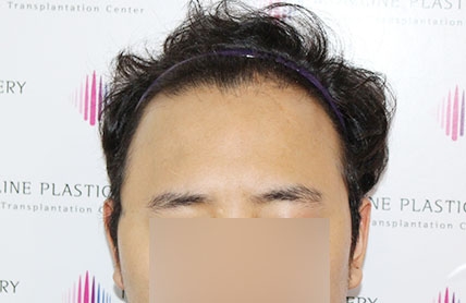 치료후기 이미지