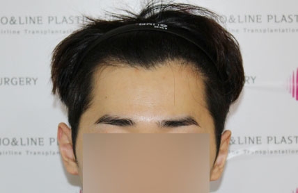 치료후기 이미지