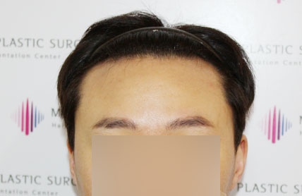 치료후기 이미지