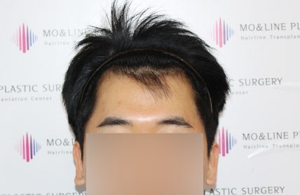치료후기 이미지