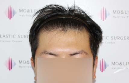 치료후기 이미지