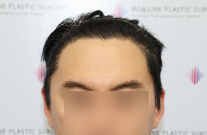 치료후기 이미지
