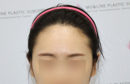 치료후기 이미지