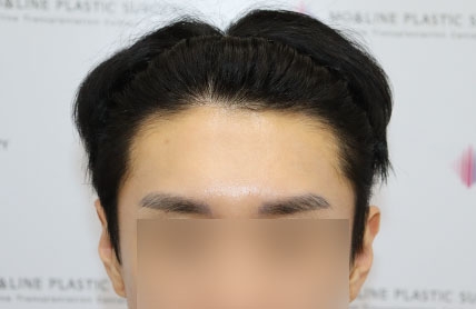 치료후기 이미지