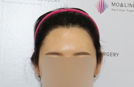 치료후기 이미지