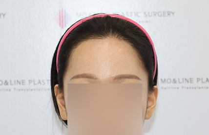 치료후기 이미지