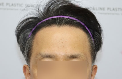 치료후기 이미지