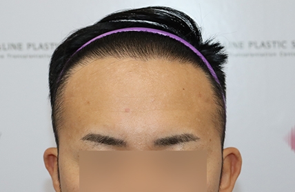 치료후기 이미지
