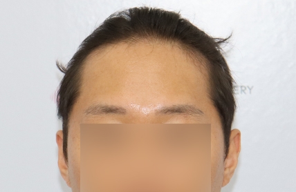 치료후기 이미지
