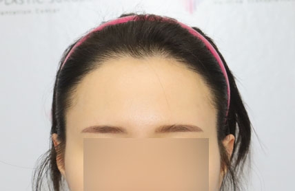 치료후기 이미지