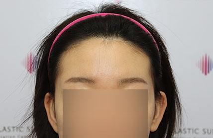 치료후기 이미지