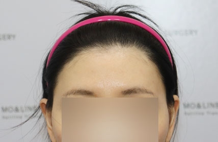치료후기 이미지