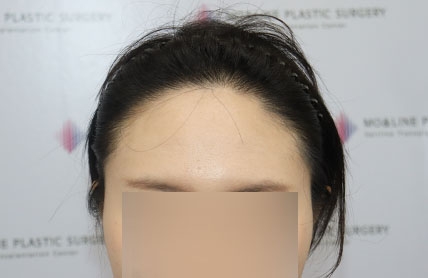 치료후기 이미지