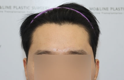 치료후기 이미지