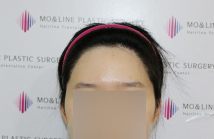 치료후기 이미지