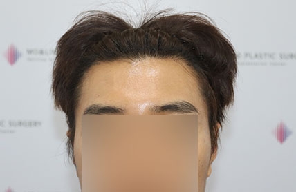 치료후기 이미지