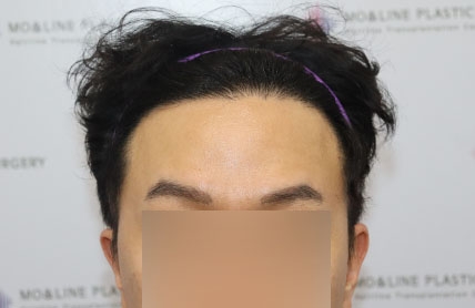 치료후기 이미지
