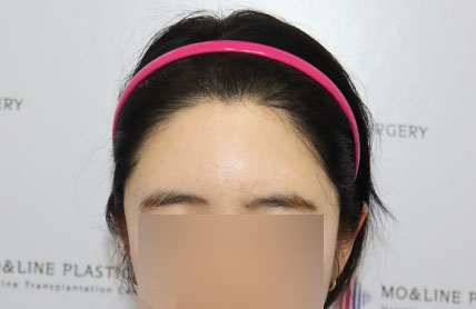 치료후기 이미지