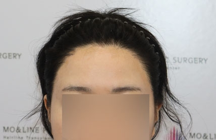 치료후기 이미지